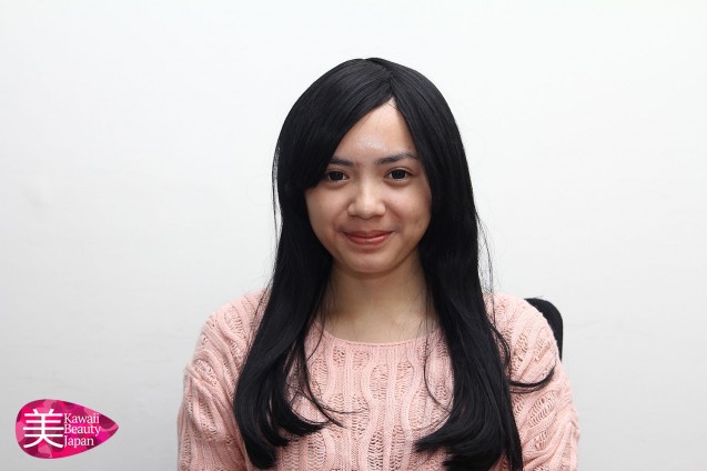 Bareface 