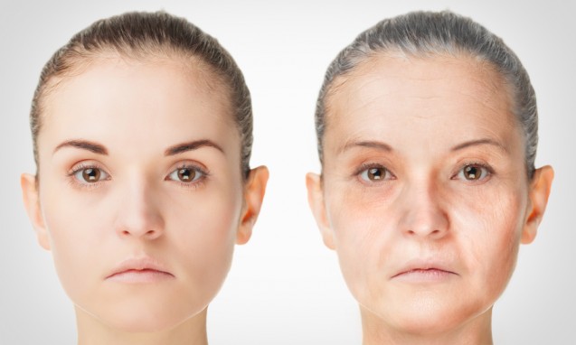 Aging