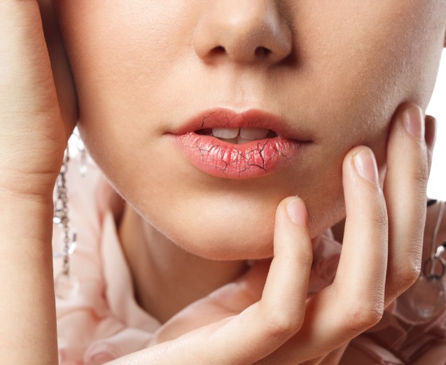 Bibir kering