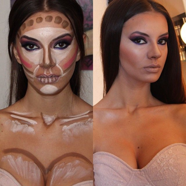 Contouring payudara