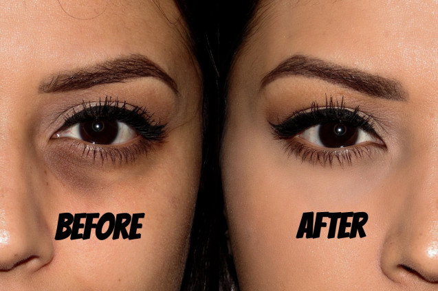 Tips cantik concealer