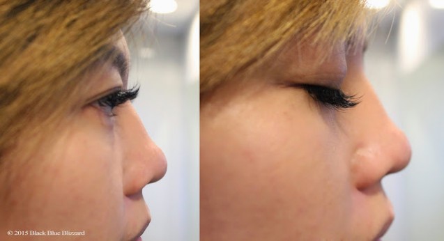 Setelah Eyelash Extention 